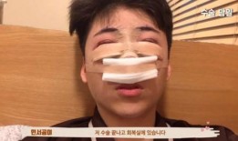 整容网红爆料视频播放在线观看,独家爆料视频在线观看